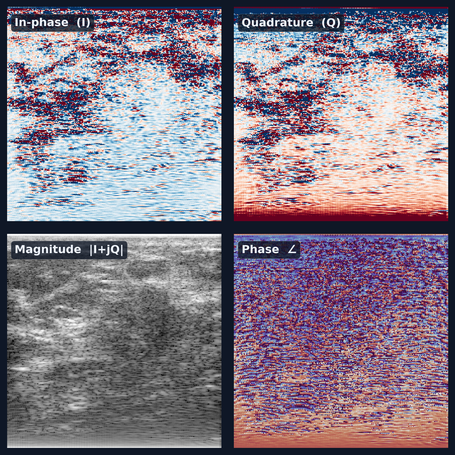 Four panels: in-phase, quadrature, magnitude, and phase channels