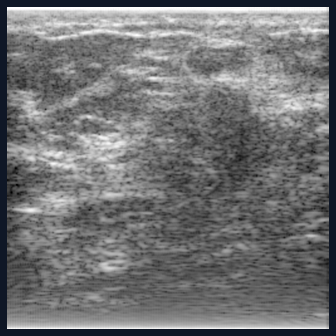 Reconstructed B-mode ultrasound image