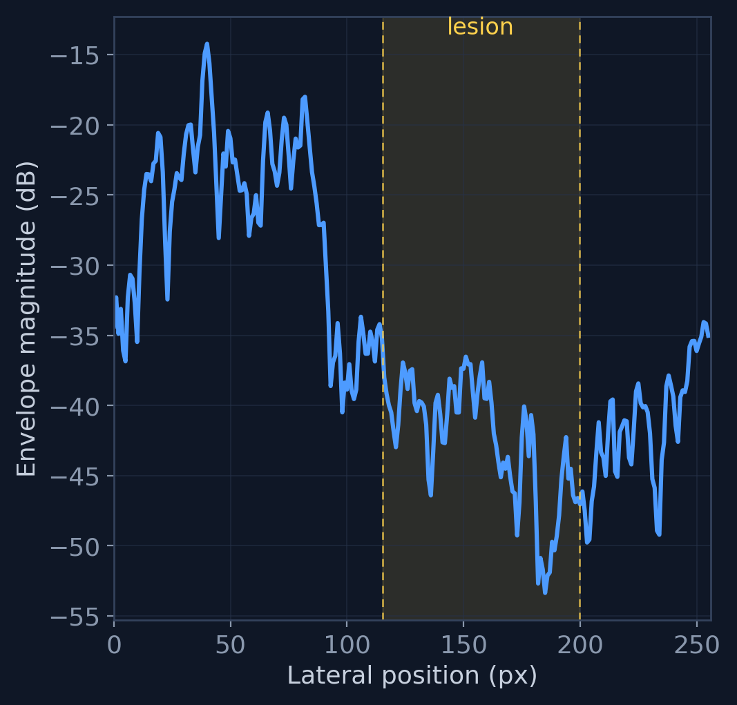 Lateral magnitude profile across the lesion